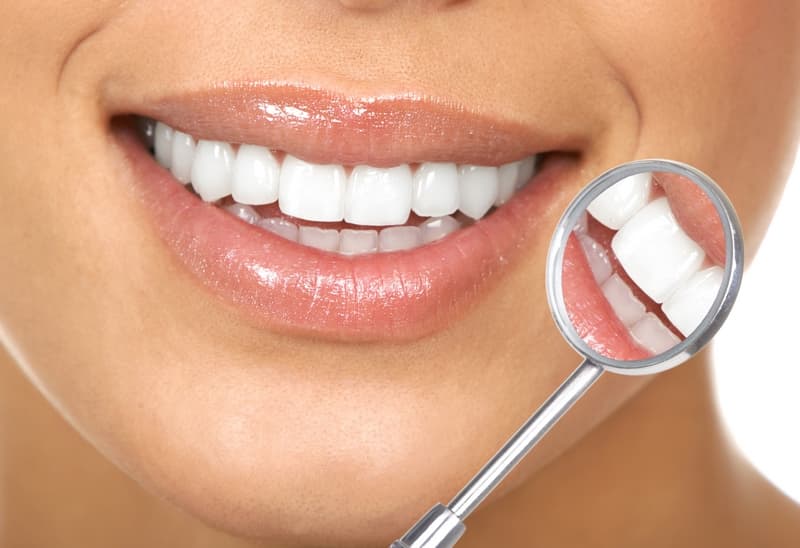 What You Need to Know Before Bleaching Your Teeth